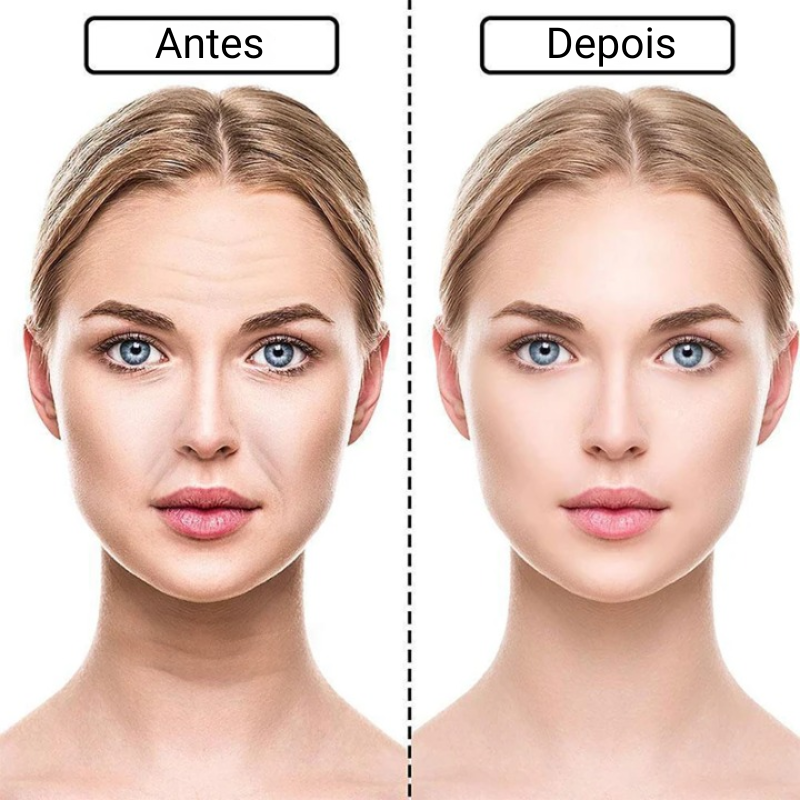 RevitaLift Adesivos: Renovação Facial Anti-Idade